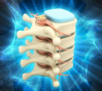 Conditions Degenerative Disc Disease by Santa Ana Pain Clinic 1 1 348x310 - Medication Management