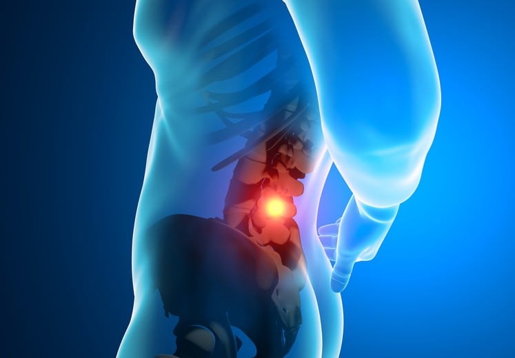 Treatments Intrathecal Pump by Santa Ana Pain Clinic 1 1 747x520 - Intrathecal Pump