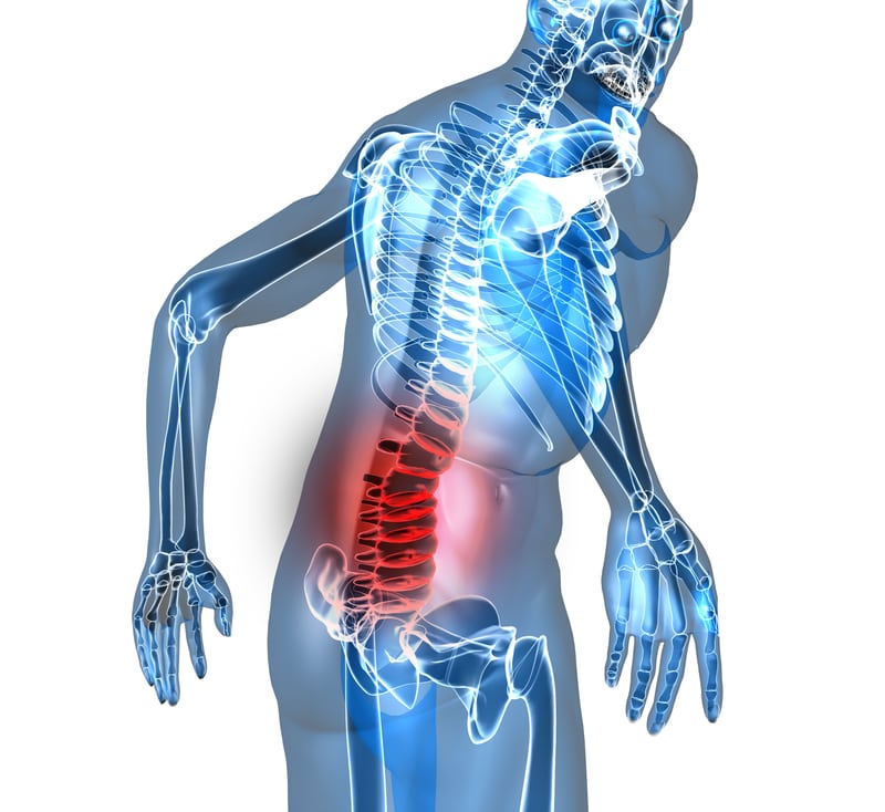Spinal Injections Santa Ana Pain Clinic 3 - Spinal Injections