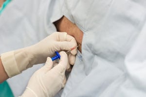 Epidural Injection Santa Ana Pain Clinic thumb - Useful Links