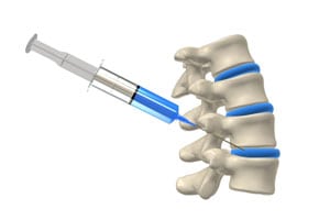Injections for Back Pain Santa Ana Pain Clinic thumb - Useful Links